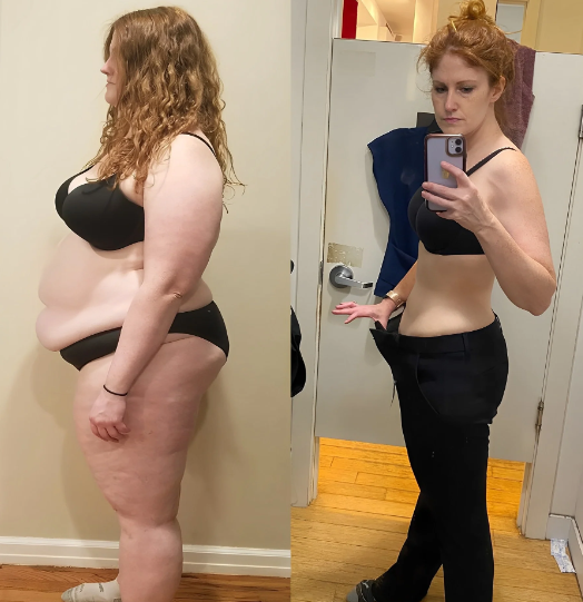 SlimaPlast™ | Lose up to 5kg – without dieting or hard exercise, in just a few days 19 1746115230 1733898022 1727441744 download%20%2810%29