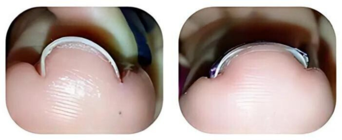 fungiGone™ Bee Venom Nail Fungus 15 1740891287 1732893177 1730726131 1726602545 Untitled%20design