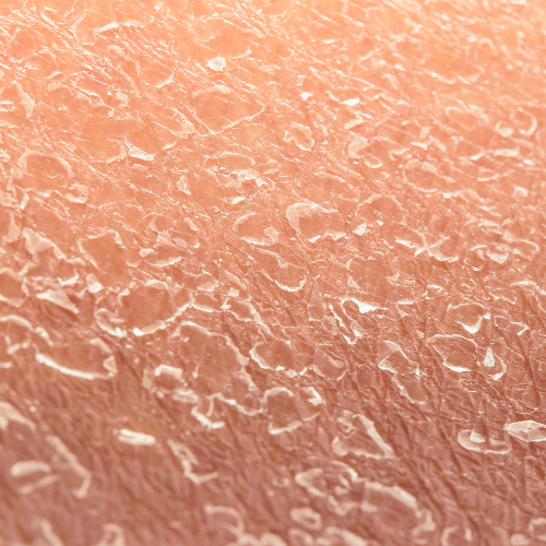 BlissSkin™ | 5 Days to Smoother, Firmer, Younger-Looking Skin! 15 1744038781 1743411109 1713276970 Noforme%CC%84jums%20bez%20nosaukuma%20 %202024 04 16T171602.927