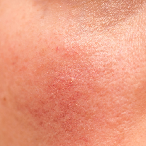BlissSkin™ | 5 Days to Smoother, Firmer, Younger-Looking Skin! 17 1744038799 1743411113 1713277287 Noforme%CC%84jums%20bez%20nosaukuma%20 %202024 04 16T172117.106
