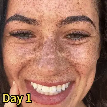 VLSVLS™ Total Body Skin Repair Cream 10 1740228416 VLS 1111 81dbece6 2528 4cb9 85f9
