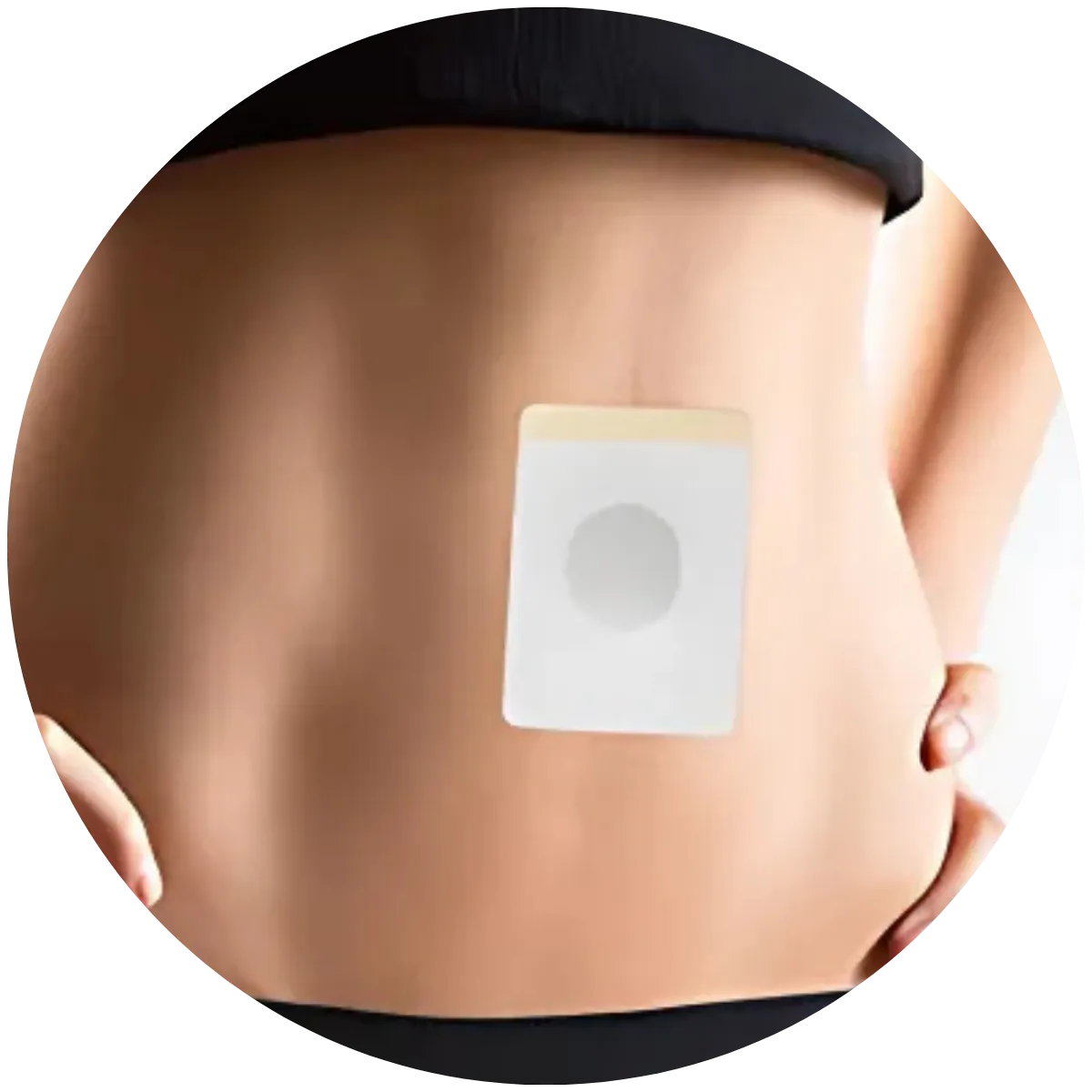 DryPatch™ Blodder Control Patch