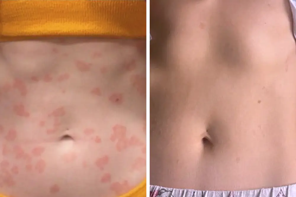 SkinClix™ | Effectively relieves itching and flaking and improves the appearance 25 SkinClix™ | Effectively relieves itching and flaking and improves the appearance