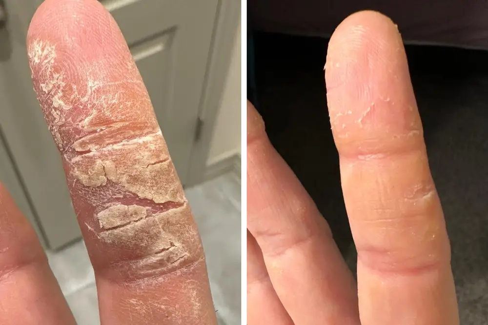 SkinClix™ | Effectively relieves itching and flaking and improves the appearance 26 SkinClix™ | Effectively relieves itching and flaking and improves the appearance