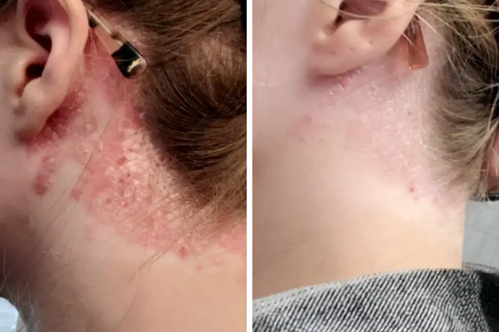 SkinClix™ | Effectively relieves itching and flaking and improves the appearance 27 SkinClix™ | Effectively relieves itching and flaking and improves the appearance