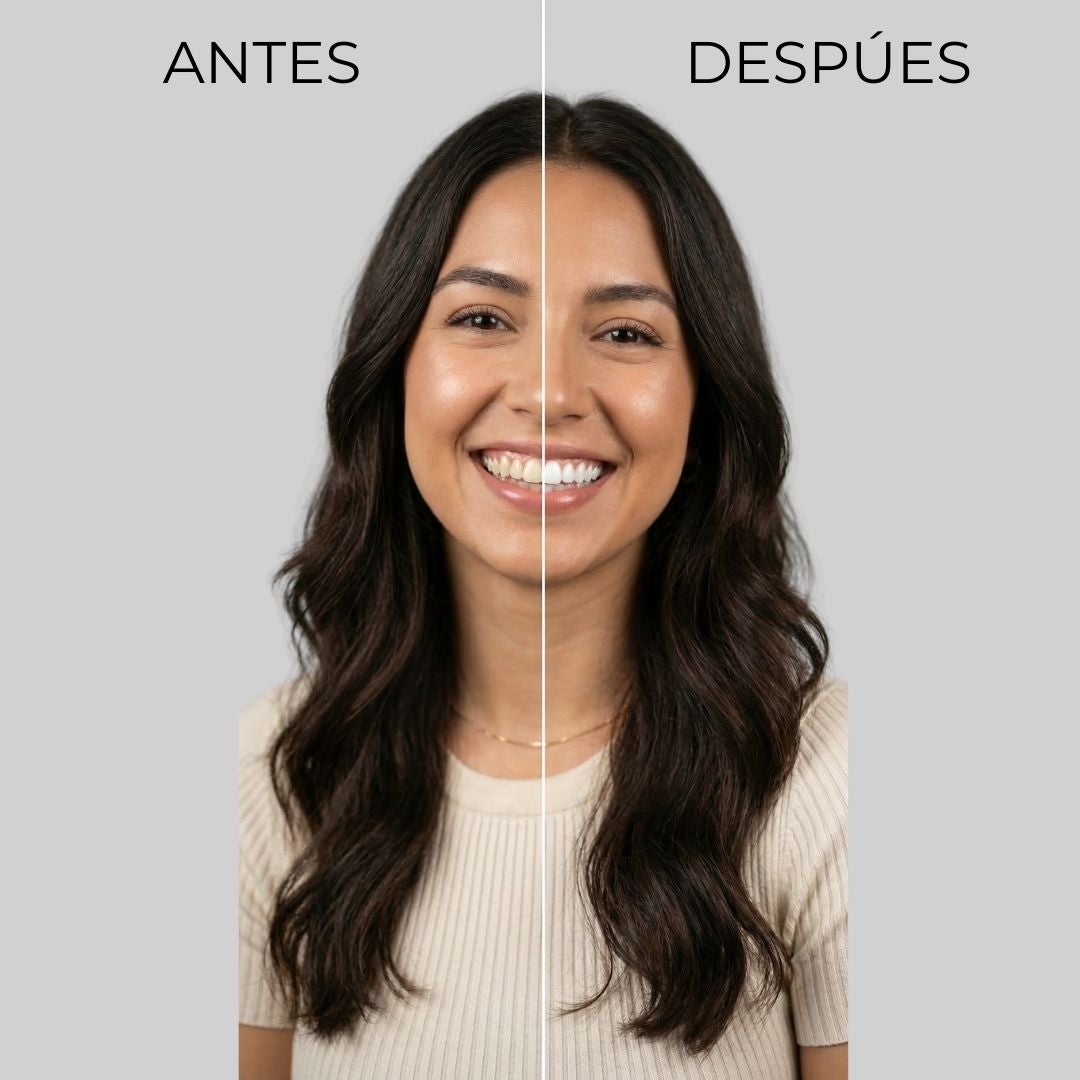 Antes y después Blanqueador Dental Led