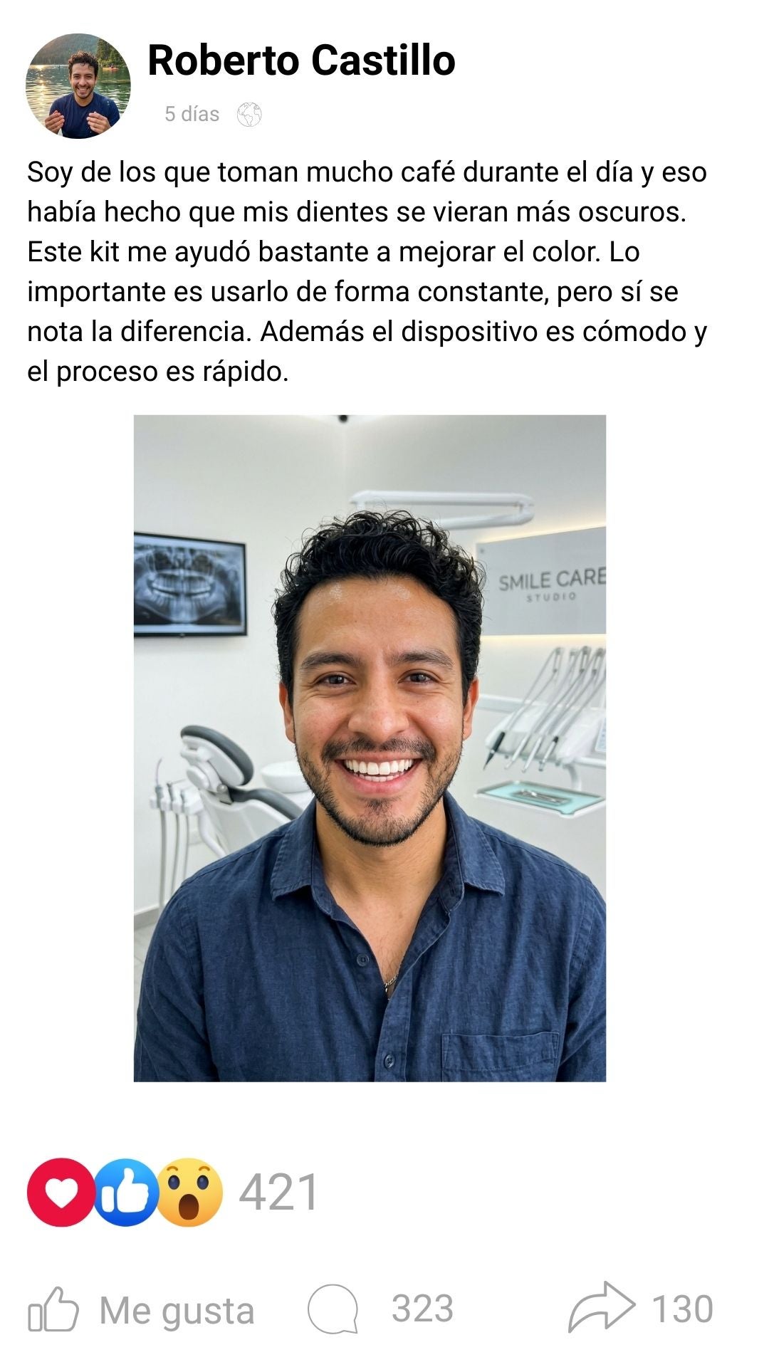 Reseña Blanqueador Dental Led