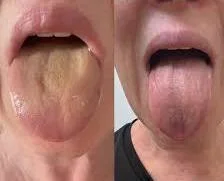 Antoine R.