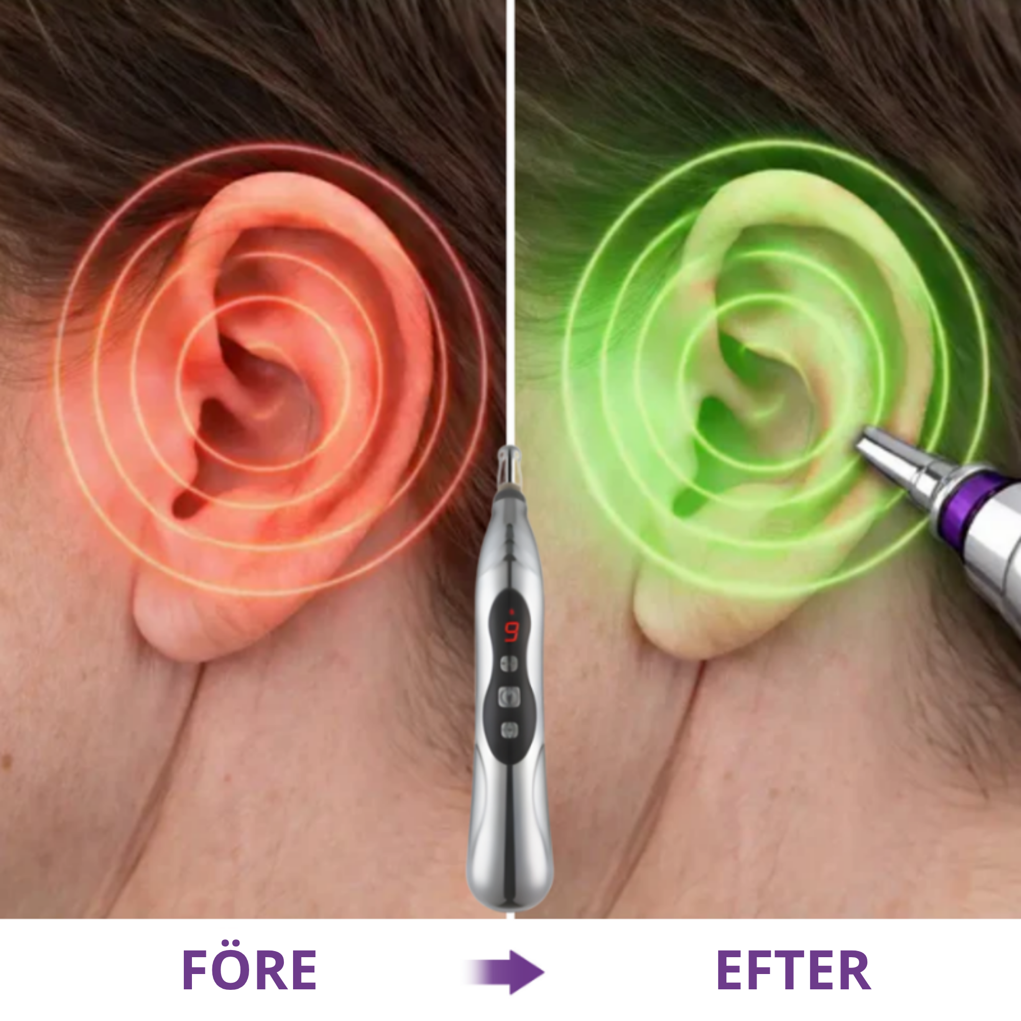 Before and after using QuietEar