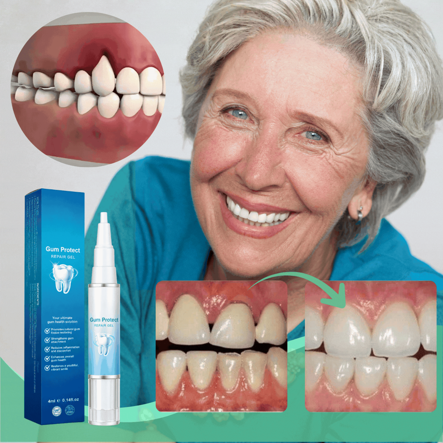 Gum Protect Oral Gel