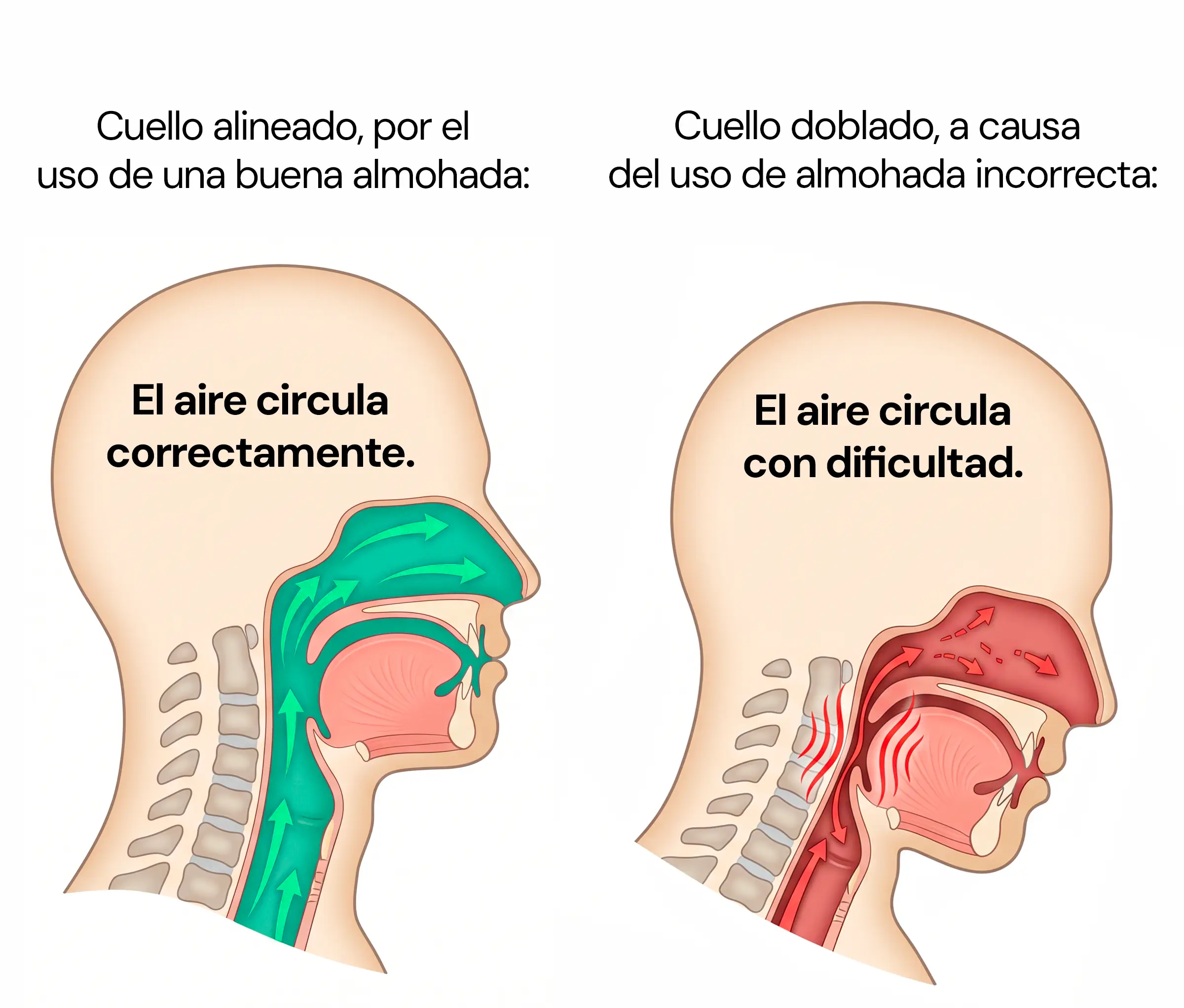 Diagrama comparativo: cuello alineado vs. cuello torcido — el efecto sobre el paso del aire por la garganta