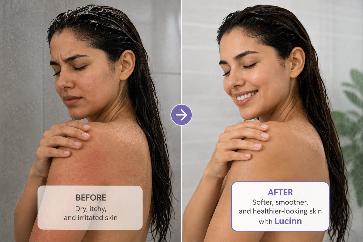 Skin comfort before and after using Lucinn