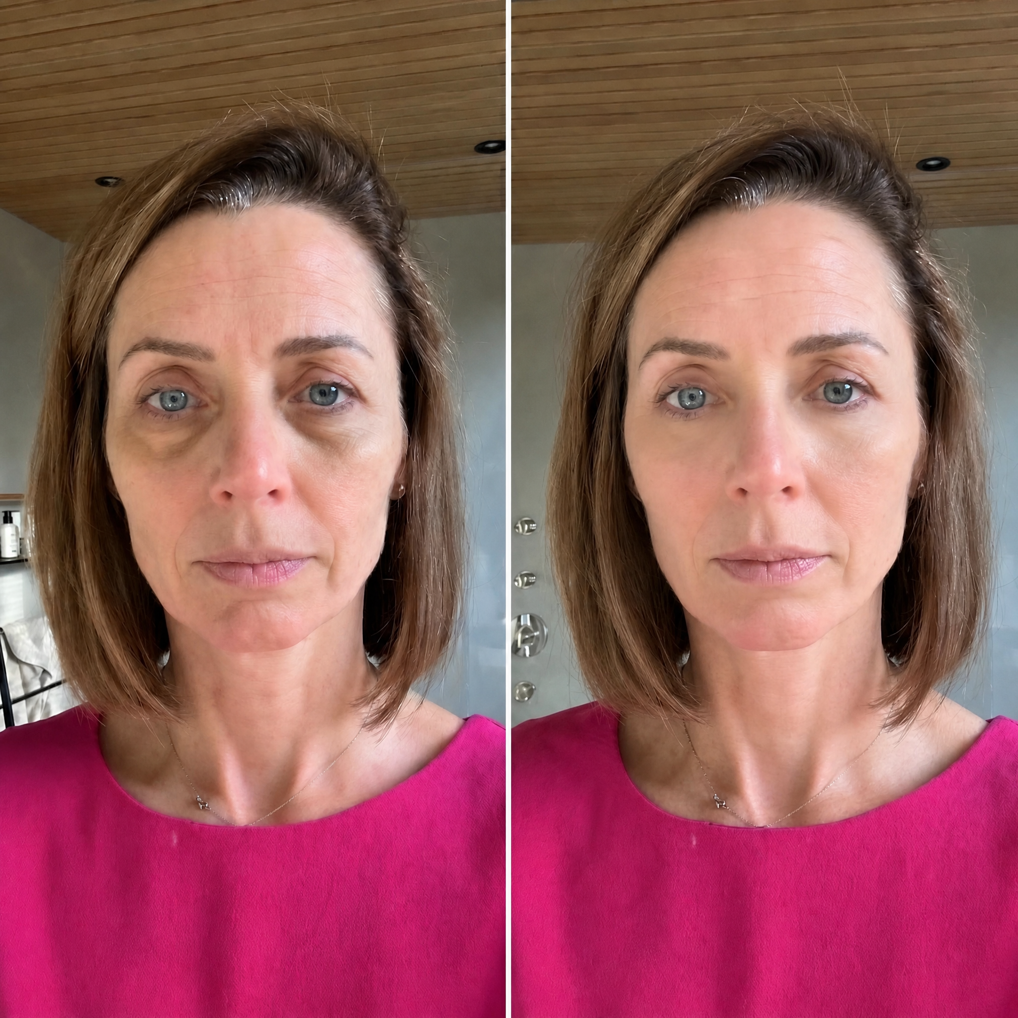 Before and after