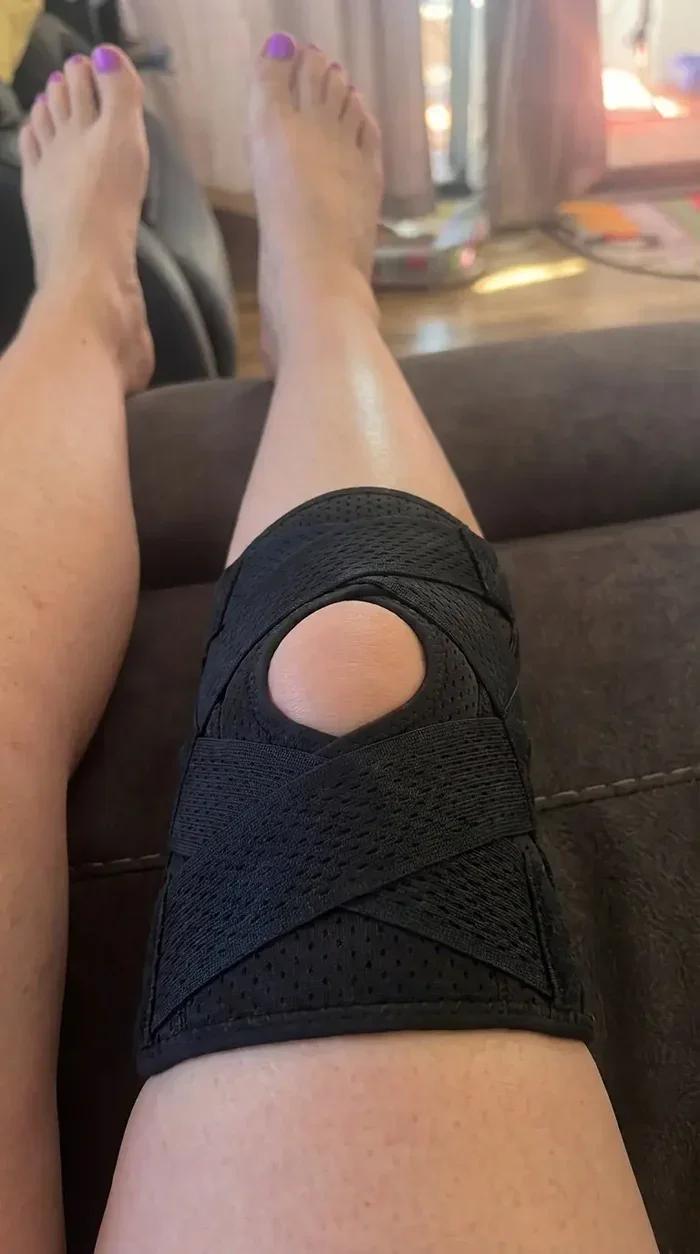 James wearing his TrueForm brace