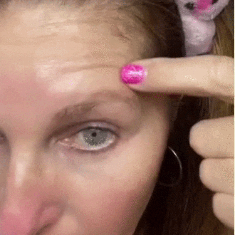 SnapLift younger-looking skin result