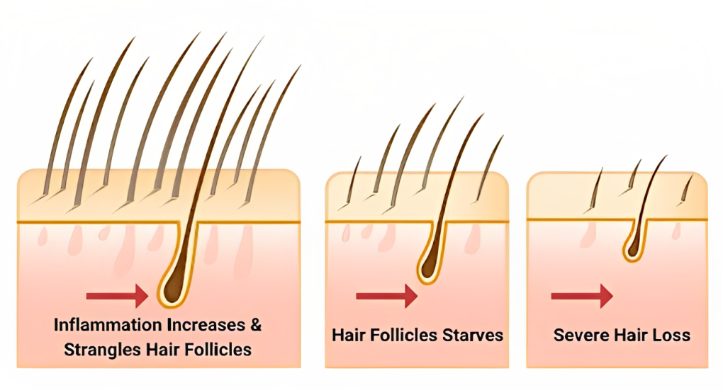Black Hair Growth Expert Shares Secret