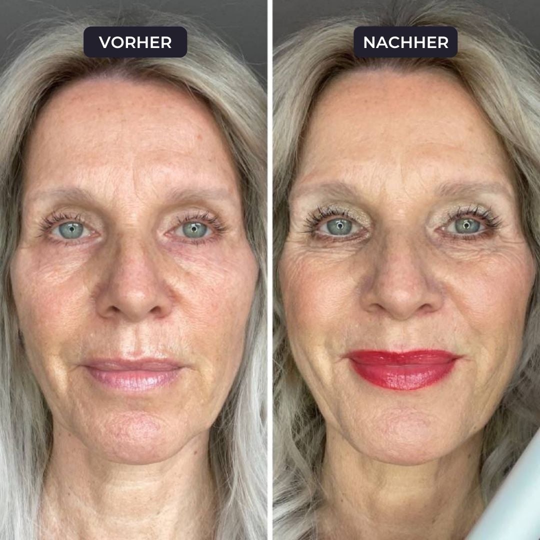 Vorher-nachher-Ergebnisse – Bewertung 3