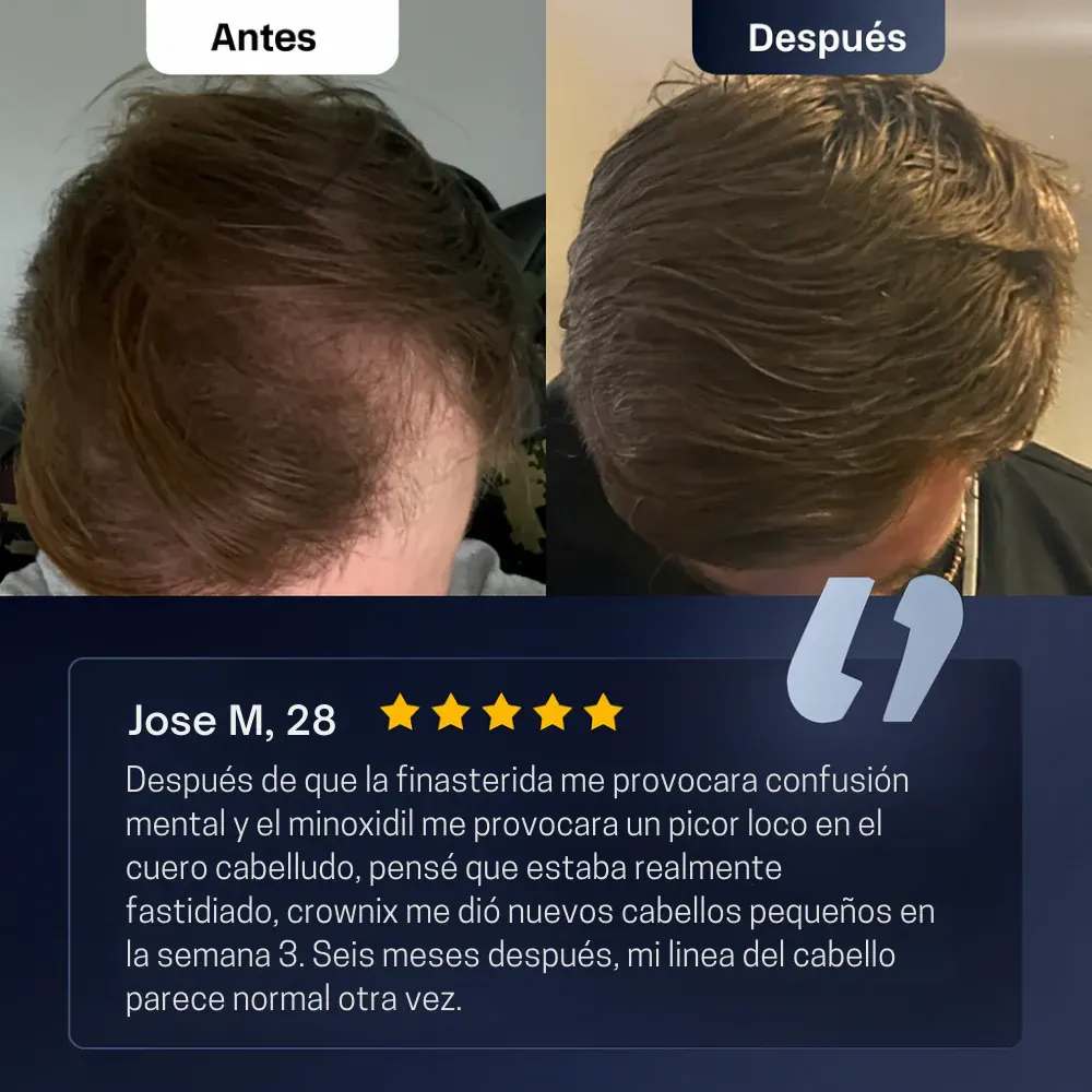 Reseña visual capilar