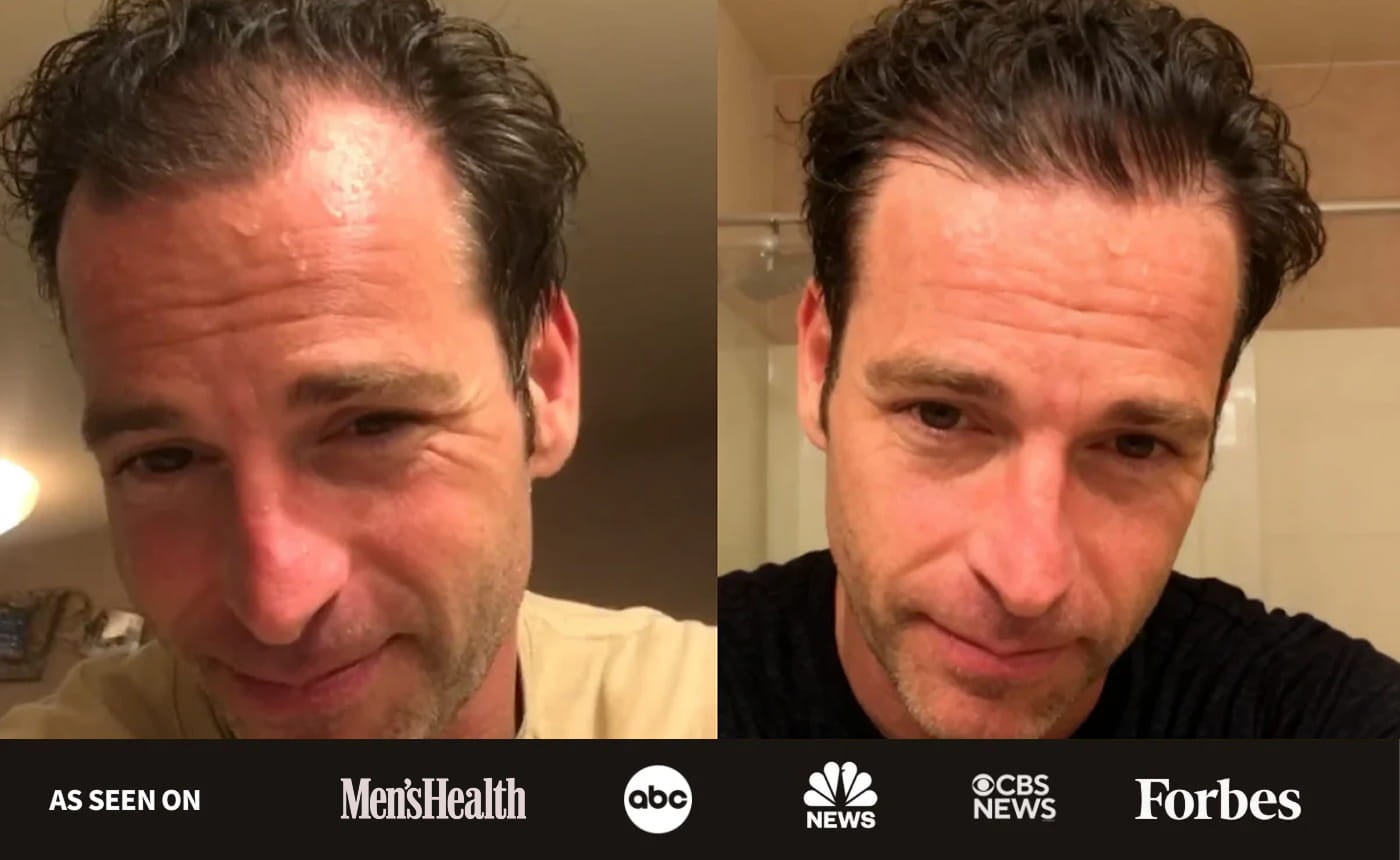 Founder before and after NovaMane