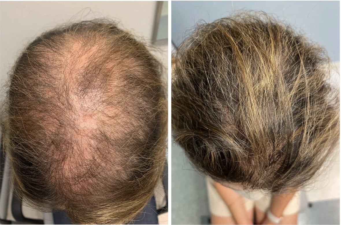 Zephta Hair Growth