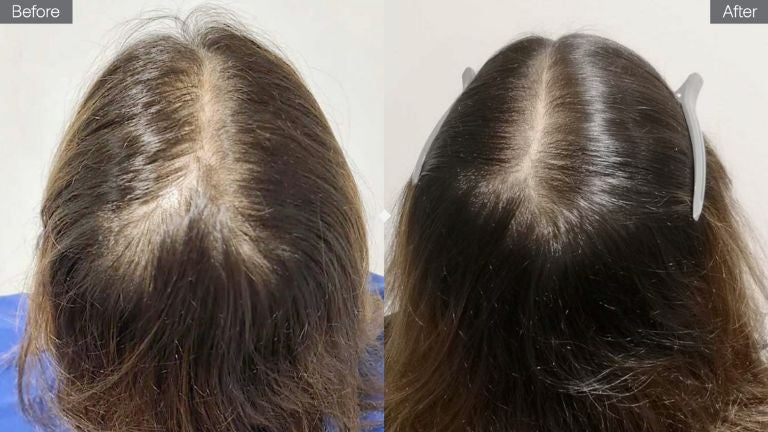 Zephta Hair Growth