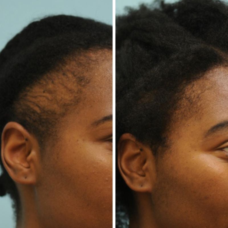 Natural Hair Growth Serum