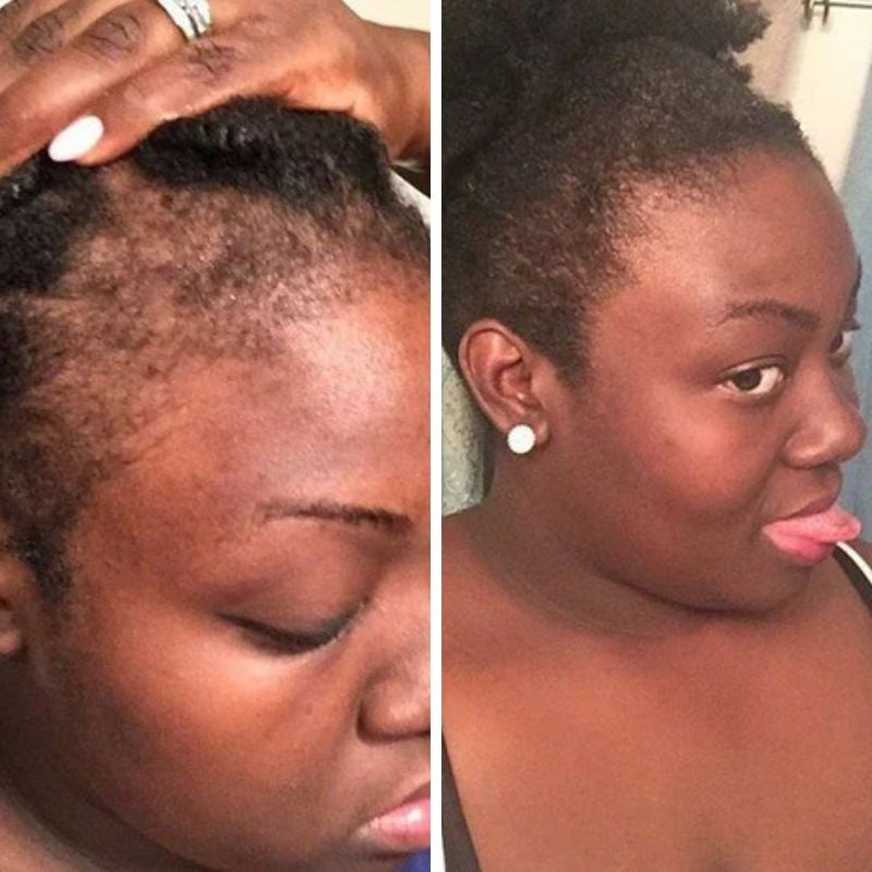 Natural Hair Growth Serum