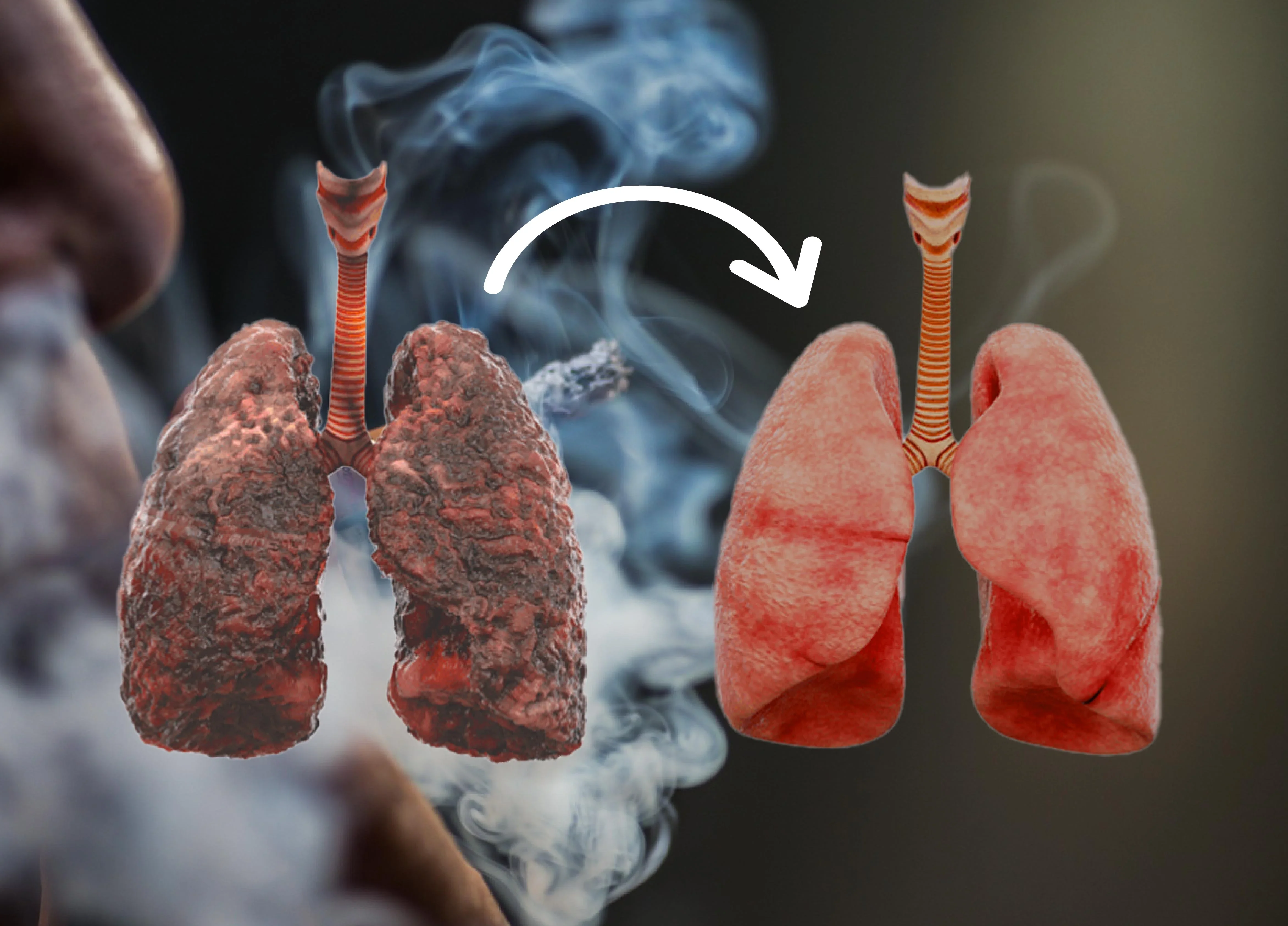Lung healing