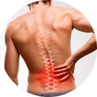 1675814298 Sciatica