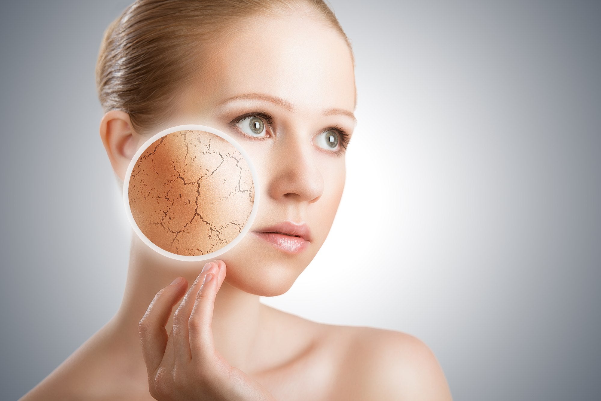 Woman with magnified dry skin patch on her cheek.