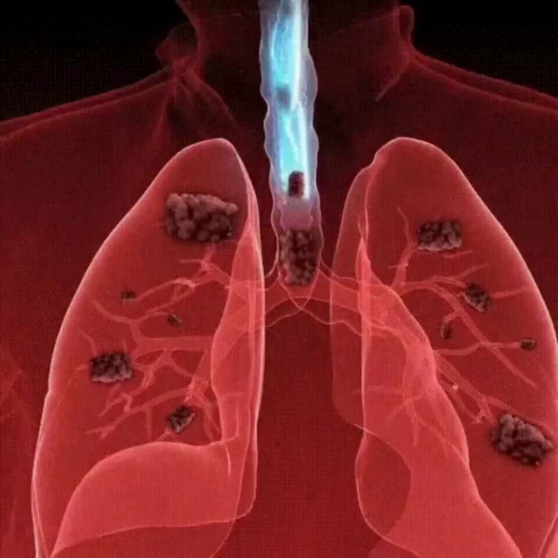 LungPure™ Lung Cleansing Spray