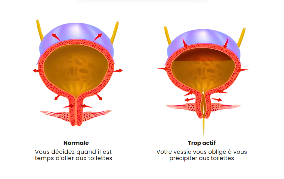 Advertorial — free download