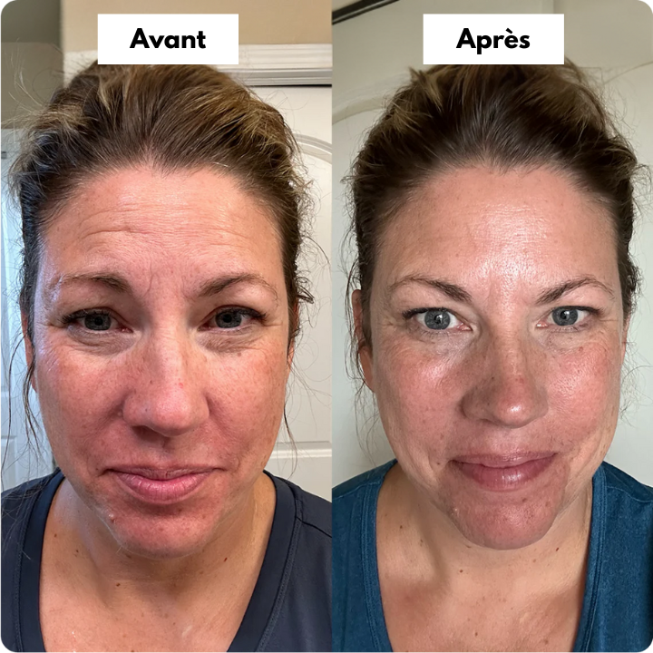 Before and After