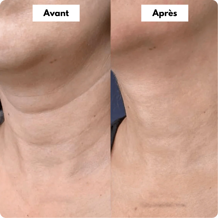 Before and After