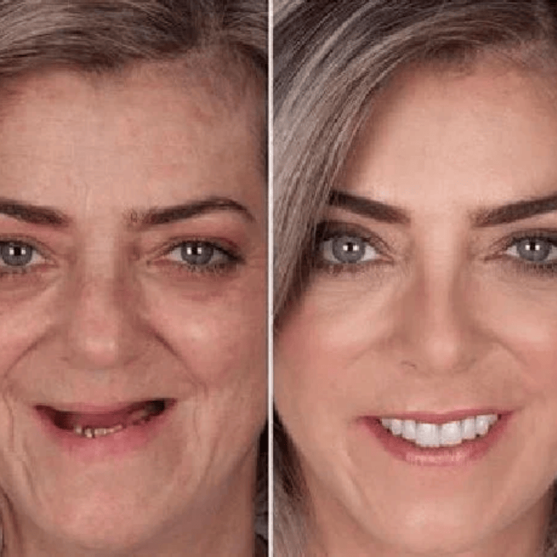 1743984694 GripGuard%20%284%29