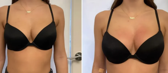 Discreet under clothes