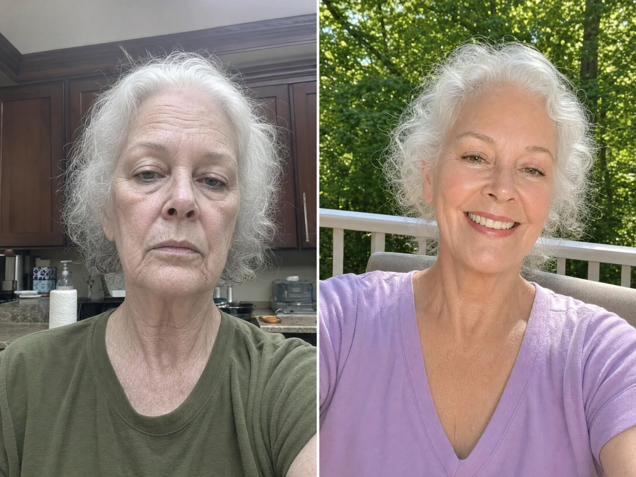 Cathy's skincare results