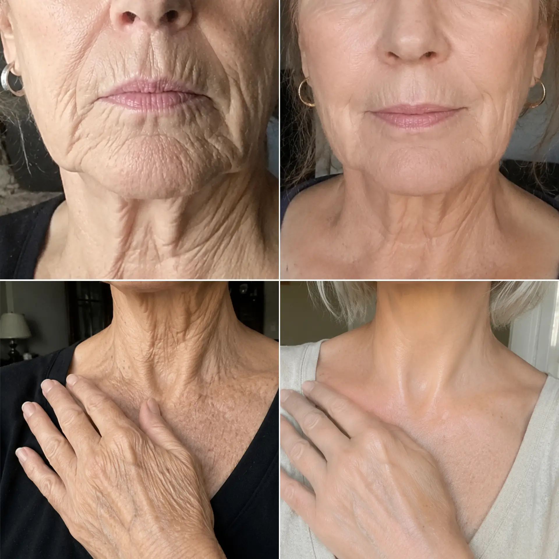 Cathy's skincare results