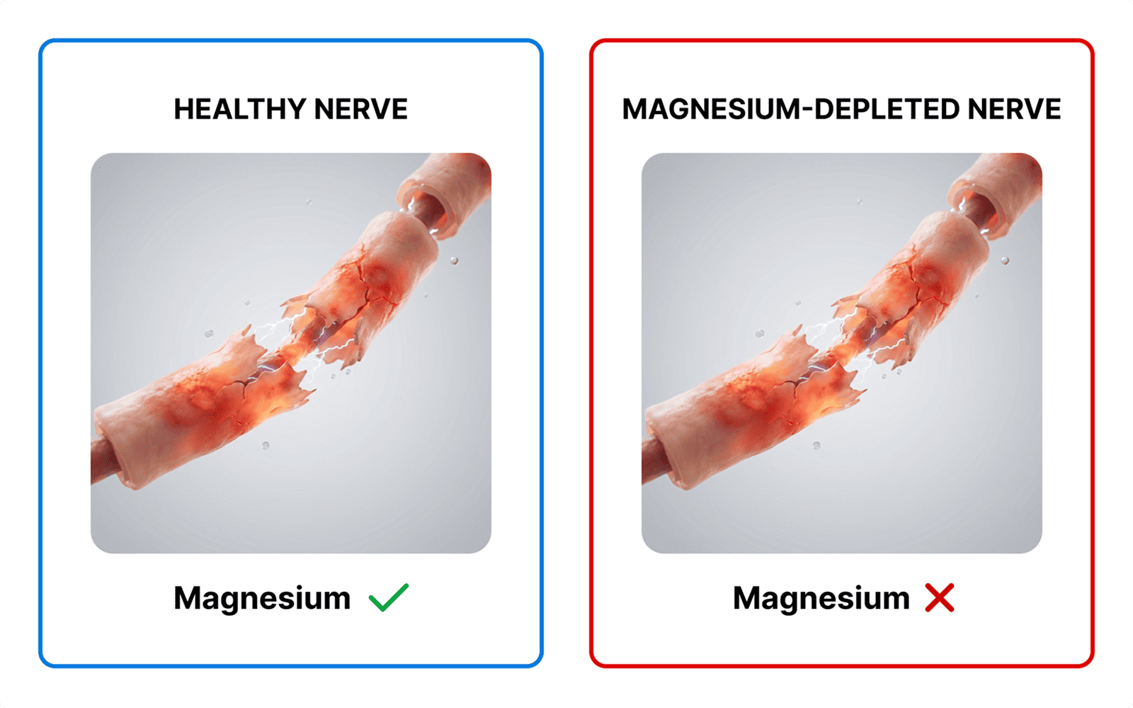 Nerve illustration