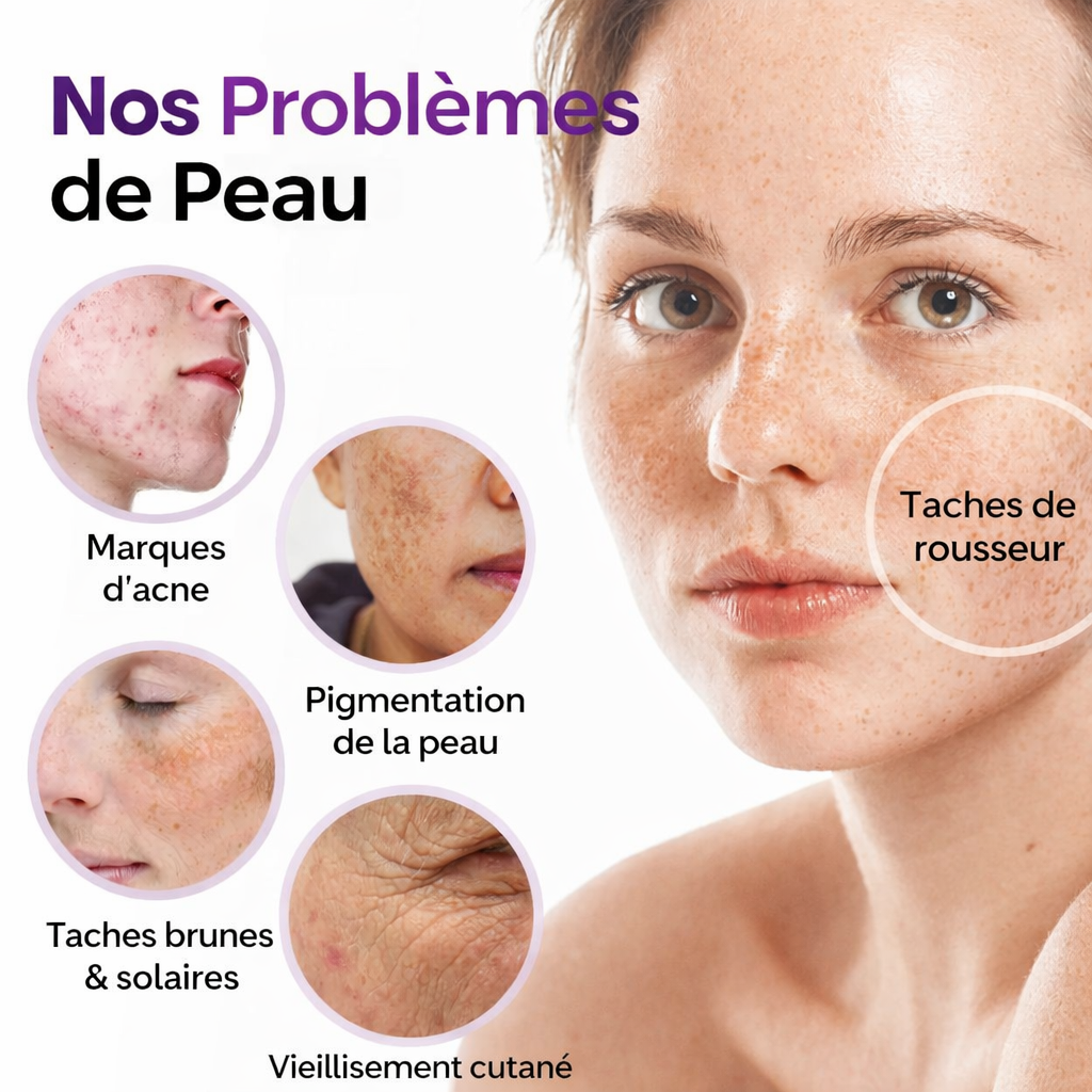 Dermaclear™ Probiotic Anti-Dark Spot Serum | Erases spots, marks and dull complexion in 3 minutes!