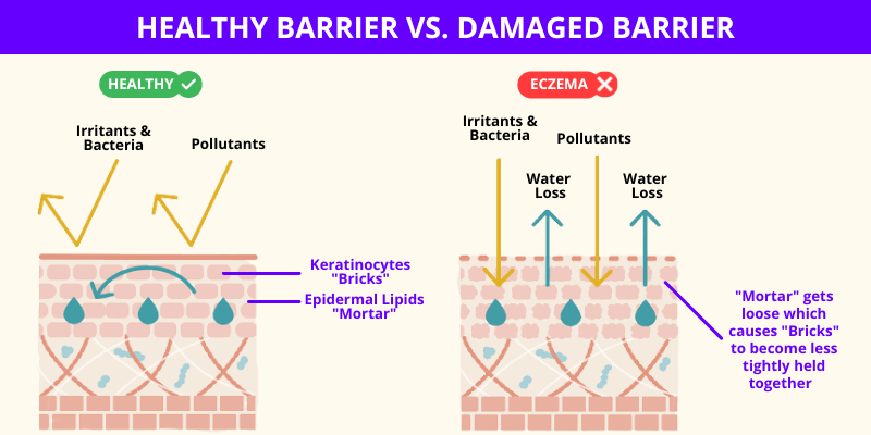 Break Your Eczema Cycle