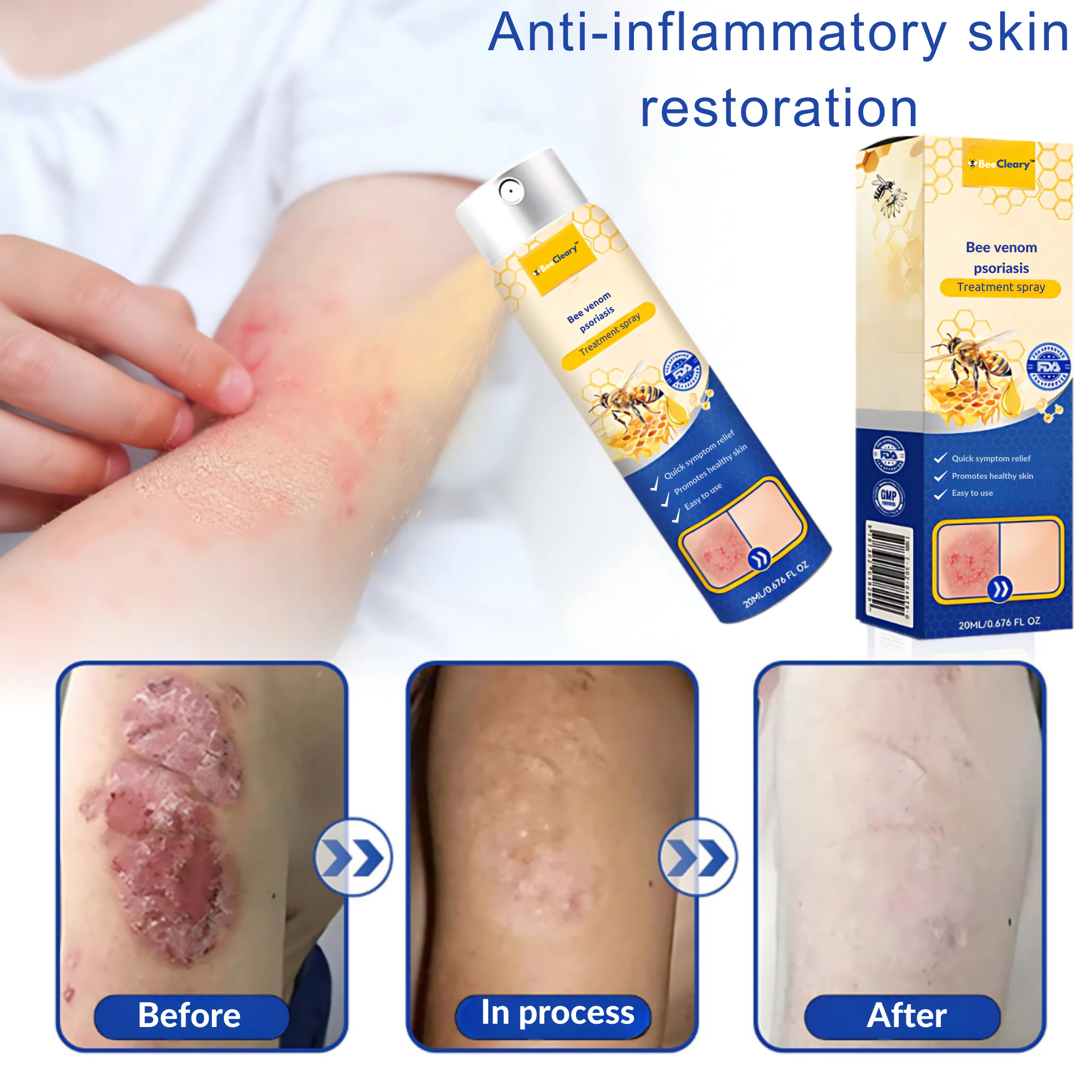 BeeCleary™ Spray | Permanently Remove Psoriasis & Eczema 20 1735735483 9