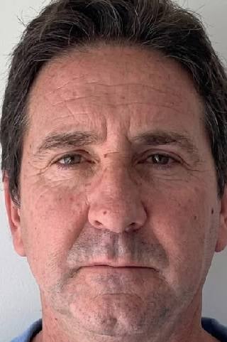 Dieter - Vorher