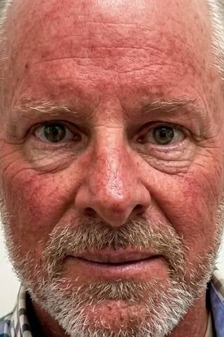 Uwe - Vorher