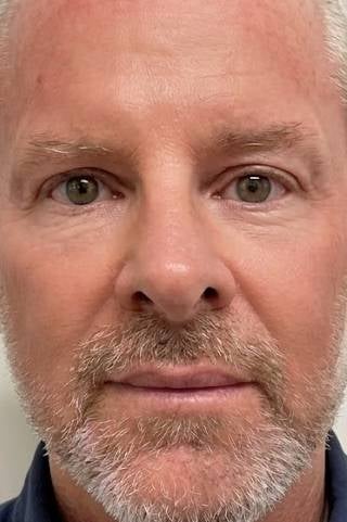 Uwe - Nachher