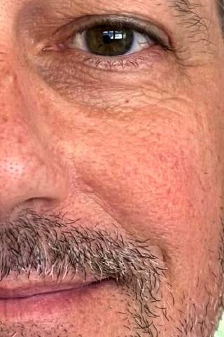 Sven - Nachher