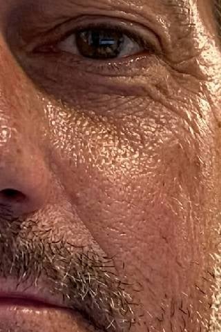 Sven - Vorher