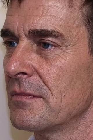 Matthias - Vorher