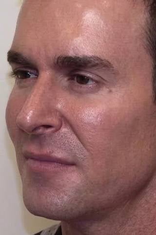 Matthias - Nachher