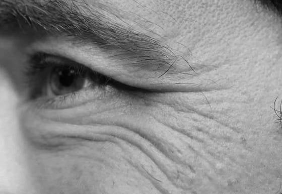 Fältchen unter den Augen